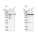 SPATA20 Antibody in Western Blot (WB)