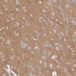 Tenascin R Antibody in Immunohistochemistry (IHC)