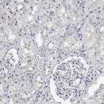 Tenascin R Antibody in Immunohistochemistry (IHC)