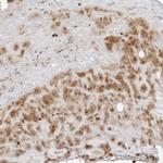 RNF146 Polyclonal Antibody