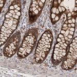 MRPL41 Antibody in Immunohistochemistry (Paraffin) (IHC (P))