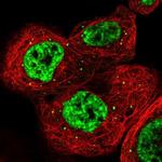 RBM6 Polyclonal Antibody