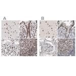 RBM6 Antibody in Immunohistochemistry (IHC)