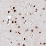 RBM6 Antibody in Immunohistochemistry (IHC)