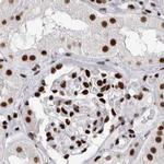 RBM6 Antibody in Immunohistochemistry (IHC)