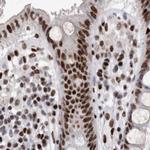 RBM6 Antibody in Immunohistochemistry (IHC)