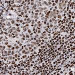 RBM6 Antibody in Immunohistochemistry (IHC)