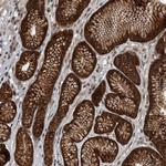 RABGGTB Polyclonal Antibody