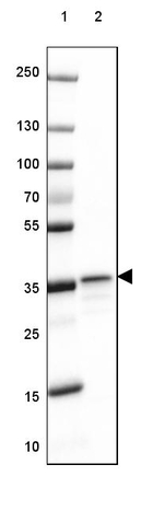 RABGGTB Antibody in Western Blot (WB)