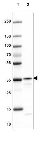 RABGGTB Antibody in Western Blot (WB)