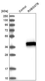 RABGGTB Antibody in Western Blot (WB)