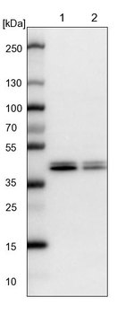 CCBL2 Antibody in Western Blot (WB)