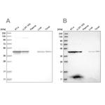 CCBL2 Antibody in Western Blot (WB)