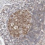 CDCA7L Antibody in Immunohistochemistry (Paraffin) (IHC (P))