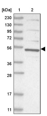 CDCA7L Antibody in Western Blot (WB)