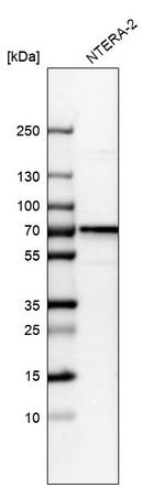 CDCA7L Antibody in Western Blot (WB)