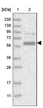 GPATCH2 Antibody in Western Blot (WB)