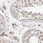 GPATCH2 Polyclonal Antibody