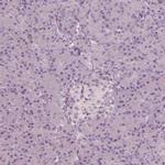 C6orf97 Antibody in Immunohistochemistry (IHC)