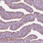 C6orf97 Antibody in Immunohistochemistry (IHC)