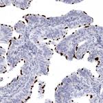 CCDC181 Antibody in Immunohistochemistry (Paraffin) (IHC (P))