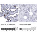 CCDC181 Antibody in Immunohistochemistry (IHC)