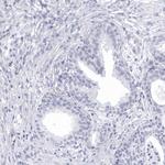CCDC181 Antibody in Immunohistochemistry (IHC)