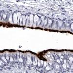 CCDC181 Antibody in Immunohistochemistry (IHC)