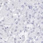 CCDC181 Antibody in Immunohistochemistry (IHC)