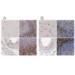 GIMAP4 Polyclonal Antibody