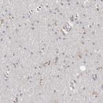 GIMAP4 Antibody in Immunohistochemistry (IHC)