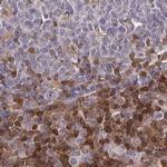 GIMAP4 Antibody in Immunohistochemistry (IHC)