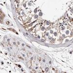 GIMAP4 Antibody in Immunohistochemistry (IHC)