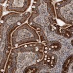 RT28 Antibody in Immunohistochemistry (Paraffin) (IHC (P))