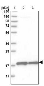 RT28 Antibody in Western Blot (WB)