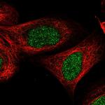 ZNF830 Polyclonal Antibody