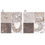 ZNF830 Antibody in Immunohistochemistry (IHC)