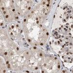ZNF830 Antibody in Immunohistochemistry (IHC)