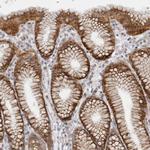 GGT6 Antibody in Immunohistochemistry (IHC)