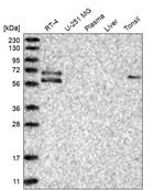 GGT6 Antibody in Western Blot (WB)