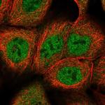 DCAF8 Polyclonal Antibody