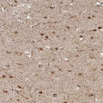 DCAF8 Antibody in Immunohistochemistry (Paraffin) (IHC (P))