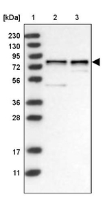 DCAF8 Antibody in Western Blot (WB)