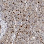 STXBP3 Antibody in Immunohistochemistry (Paraffin) (IHC (P))