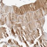 STXBP3 Antibody in Immunohistochemistry (Paraffin) (IHC (P))