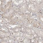 STXBP3 Antibody in Immunohistochemistry (IHC)