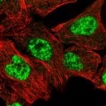 PRPF3 Polyclonal Antibody