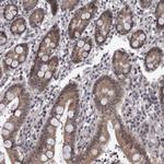 PRPF3 Antibody in Immunohistochemistry (Paraffin) (IHC (P))