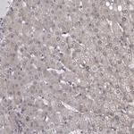 PRPF3 Antibody in Immunohistochemistry (Paraffin) (IHC (P))