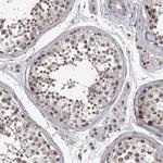 PRPF3 Antibody in Immunohistochemistry (Paraffin) (IHC (P))